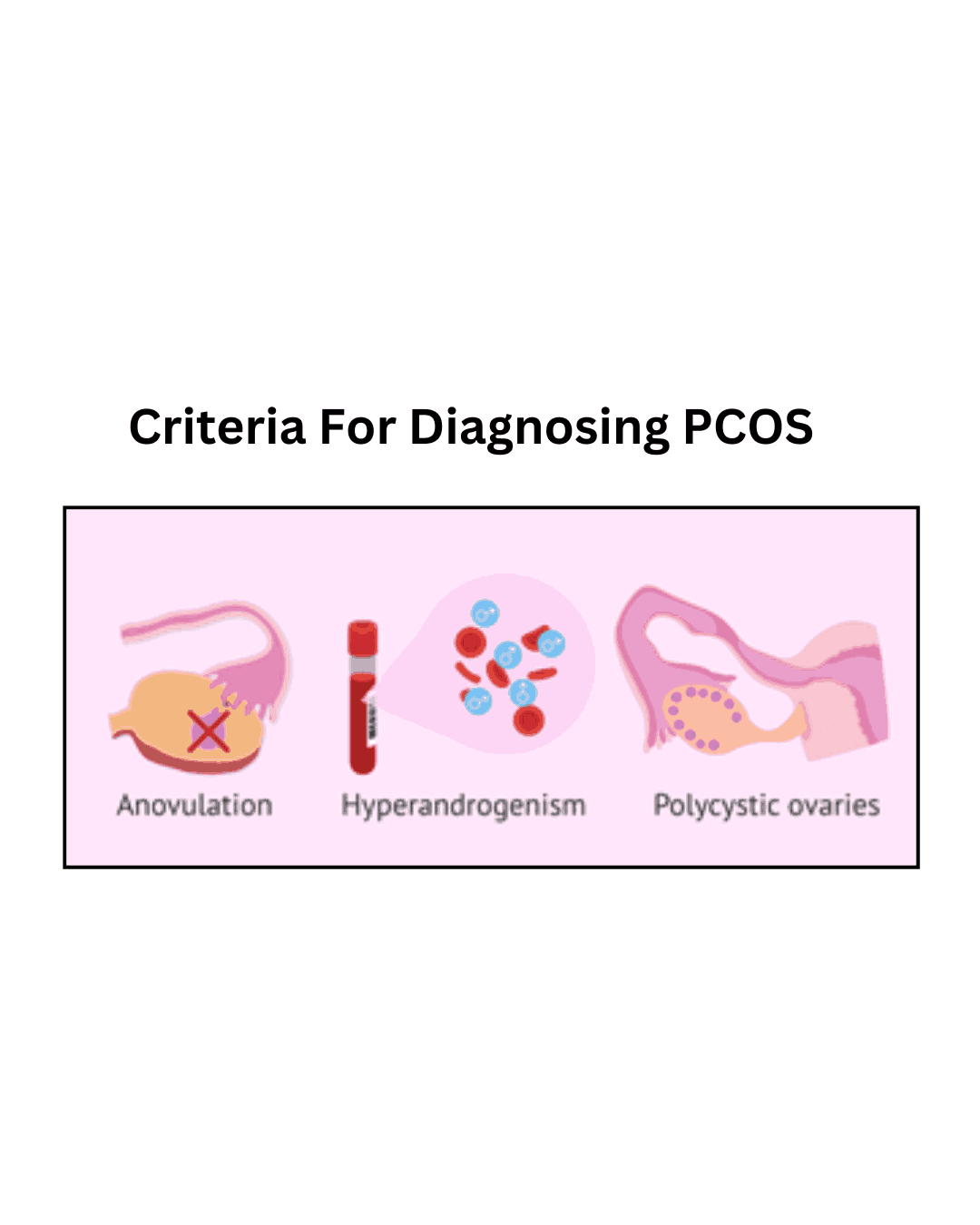 Diagnosis PCOS