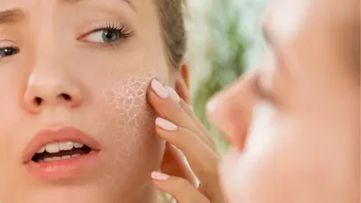 Dull skin in summer